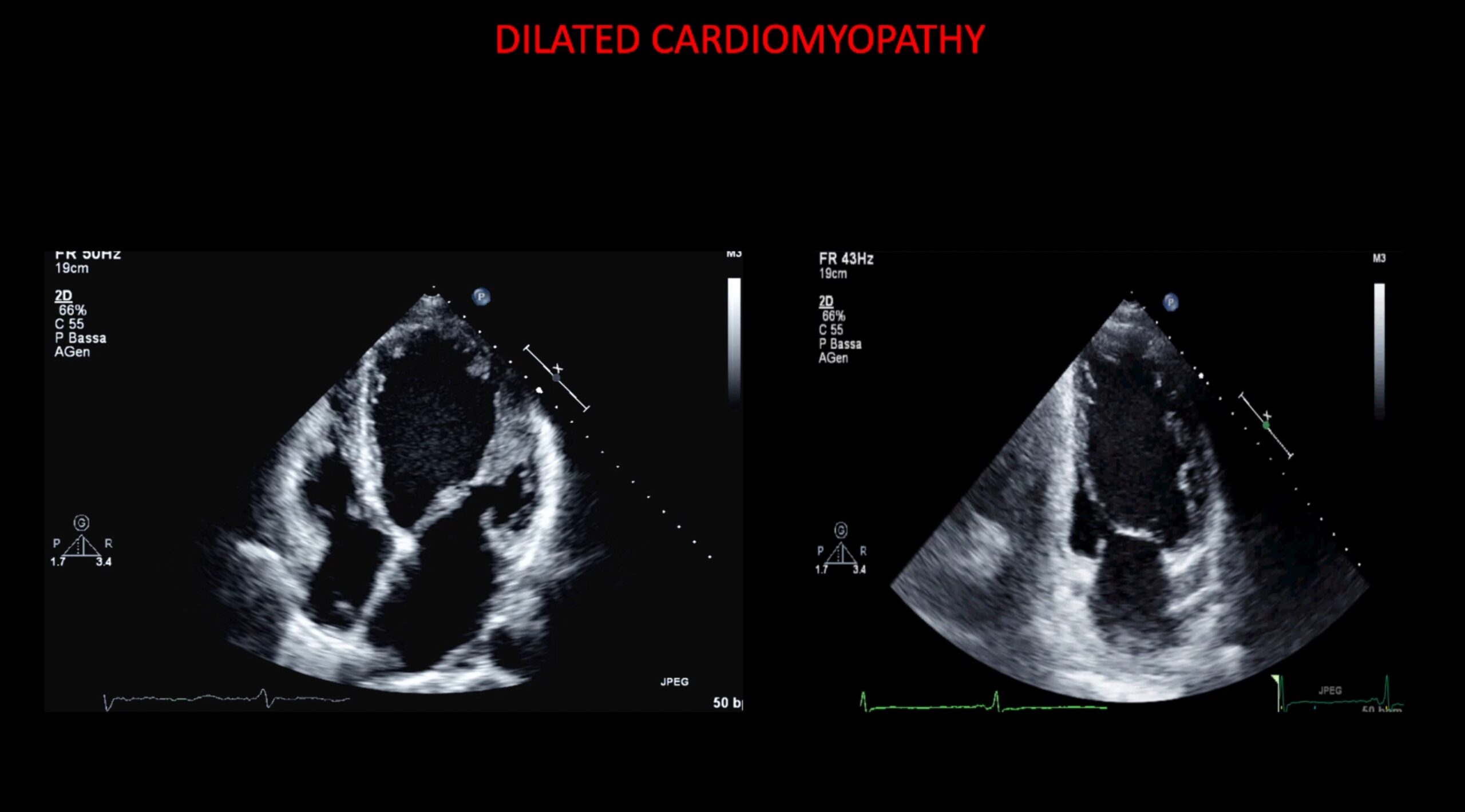 Haiku Echo 04 Cardiac Imaging Agor haiku-echo-04-cardiac-imaging-agor