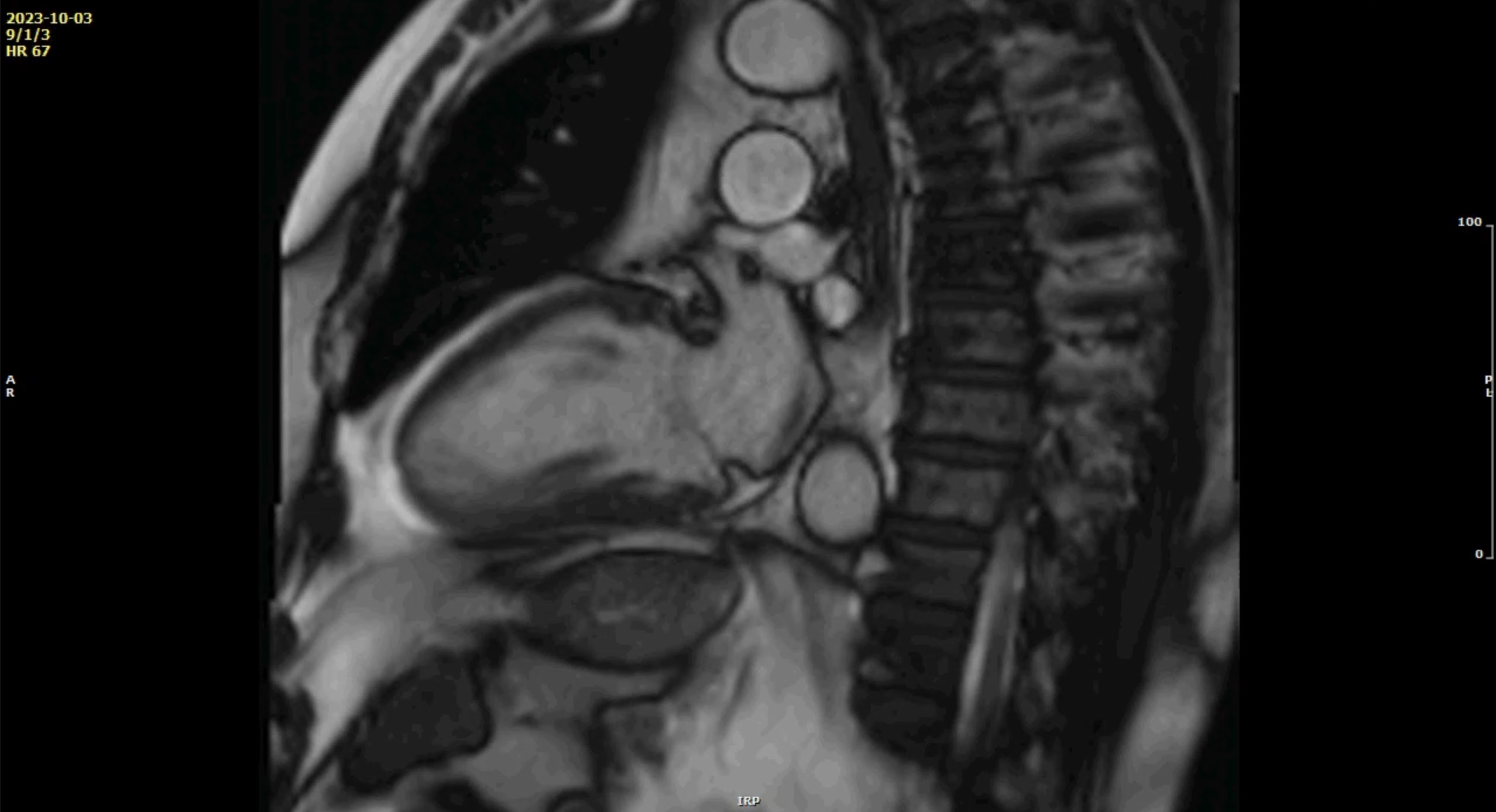 MCQ : CMR-18